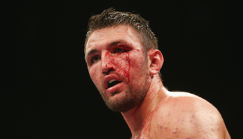 Hughie Fury - Samuel Peter: el británico quiere continuar su recuperación y enfrentará a un ex campeón mundial